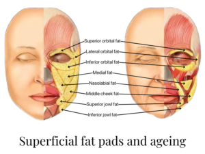 fat volume loss melbourne dermal filler