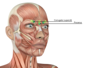 wrinkle treatment